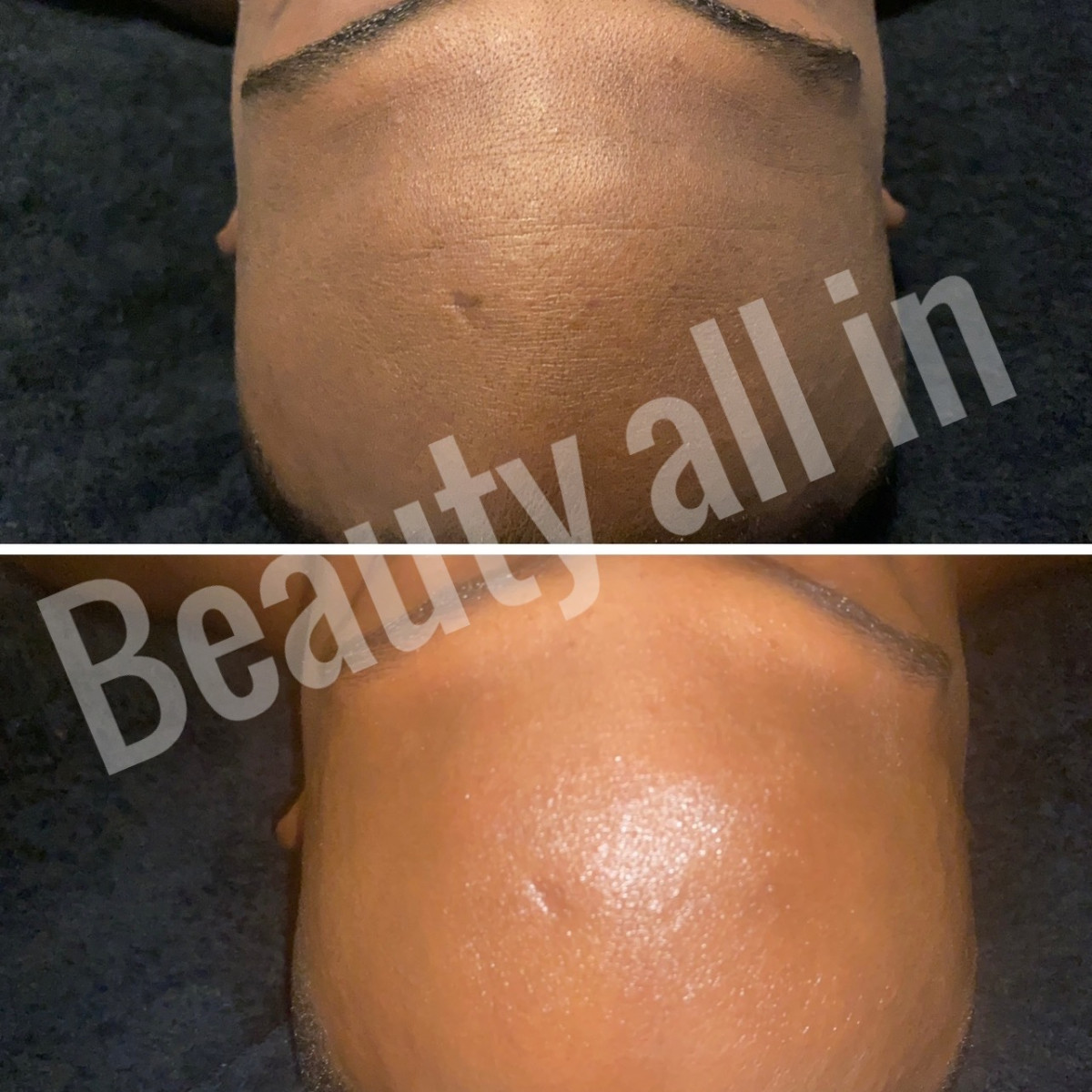 photo - Beauty All in