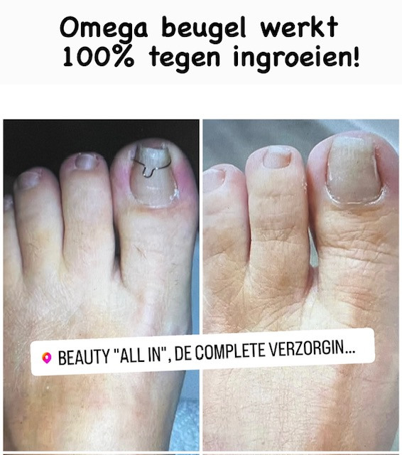 photo - Beauty All in